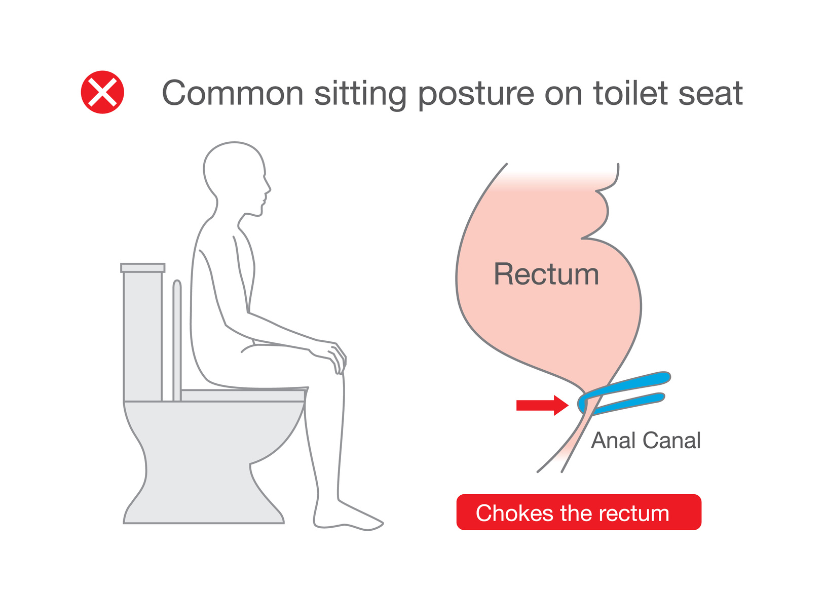 How To Sit On The Toilet Correct Toilet Posture - Squat Easy